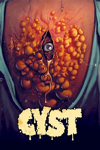 Cyst - La ciste assassina poster