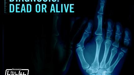 Diagnosis: Dead or Alive poster